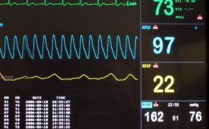 Blood pressure monitoring hospital